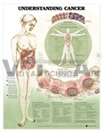 Understanding Cancer Anatomical Chart